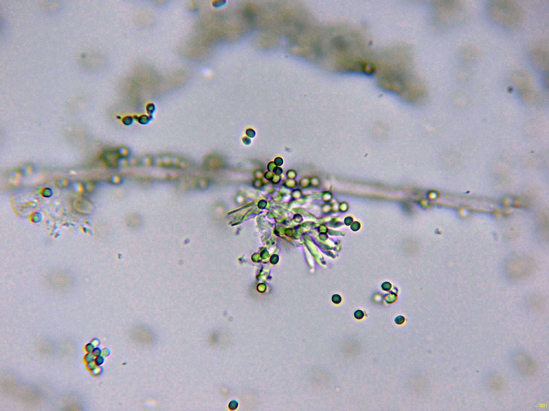 Microscopía de Talaromyces pinophilus - 10 - Fialides agua-001